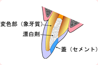 図2